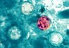 cyclospora-406 cyclospora-406