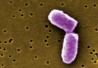 e-coli-406x250 e-coli-406x250