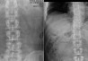 Norman X-ray