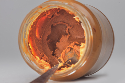 Typhoid Fever Cases in Colorado Linked to Restaurant foto Typhoid Fever Cases in Colorado Linked to Restaurant images