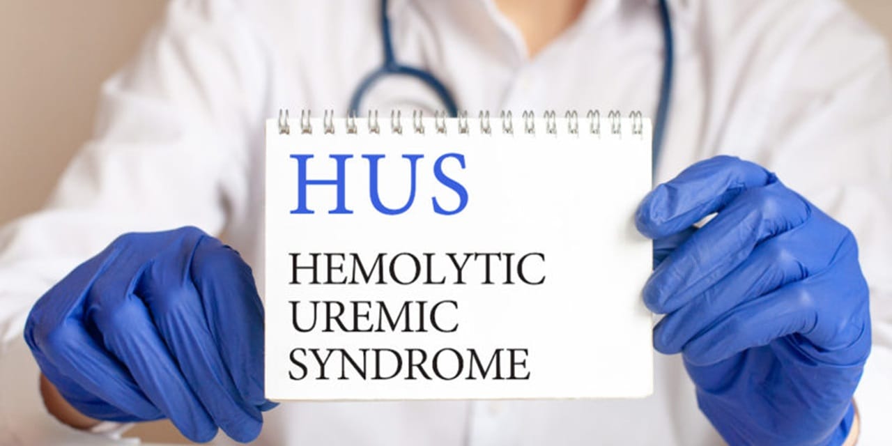 Scientist awarded grant to study severe E. coli complication