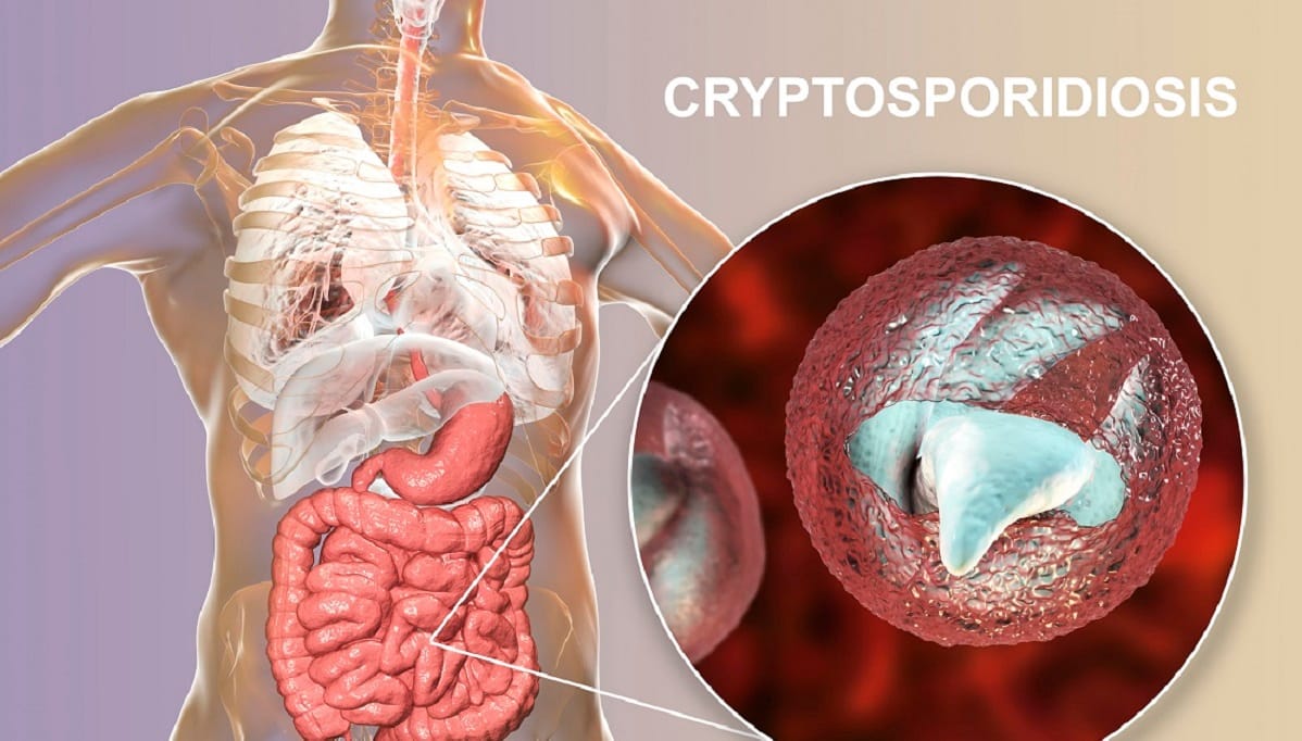 Spike in cryptosporidium parasitic infections prompts warning in Ireland |  Food Safety News