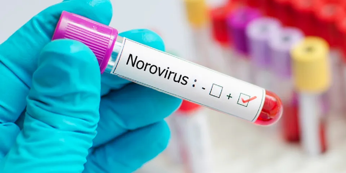 Hundreds sickened in Hungarian Norovirus outbreak