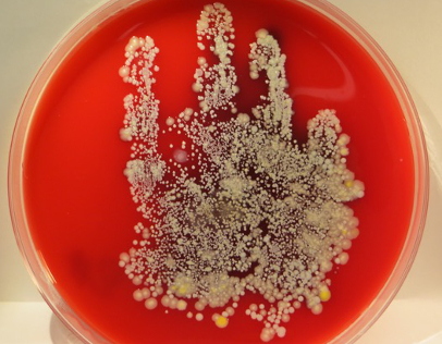 This handprint from a healthcare worker shows how much bacteria can be hiding in plain sight. (Photo courtesy of Henry Ford Health System)