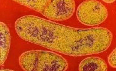 This is a colored transmission electron micrograph of the Gram-positive anaerobic bacteria Clostridium botulinum. Photo courtesy of CDC