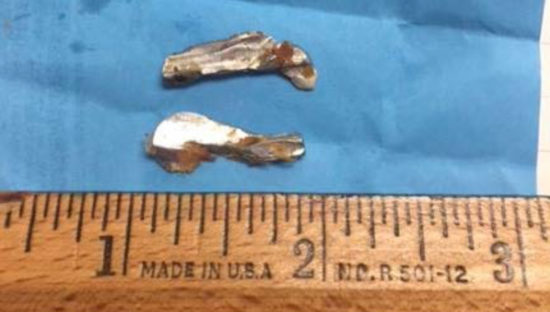 metal-bits-from-Ada-meatloaf-550x312.jpg