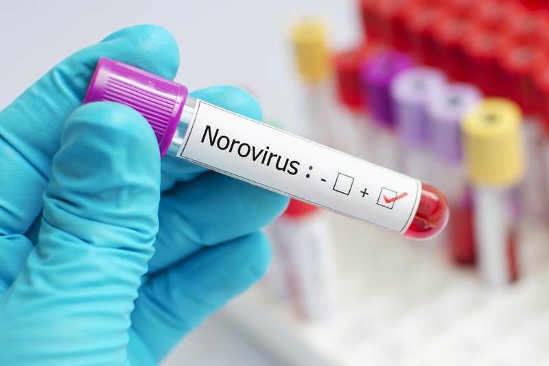 Norovirus sickens more than 120 in Slovenia; contaminated packaging suspected thumbnail