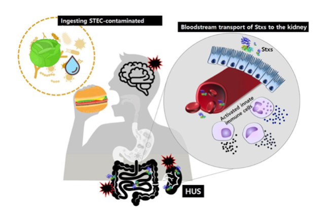 Hemolytic Uremic Syndrome Hus