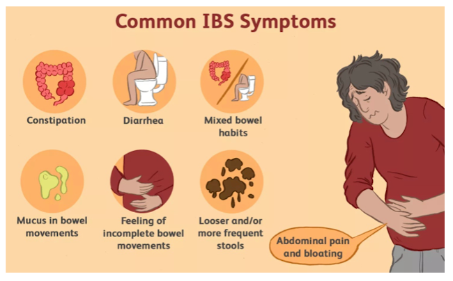 Irritable Bowel Syndrome Ibs