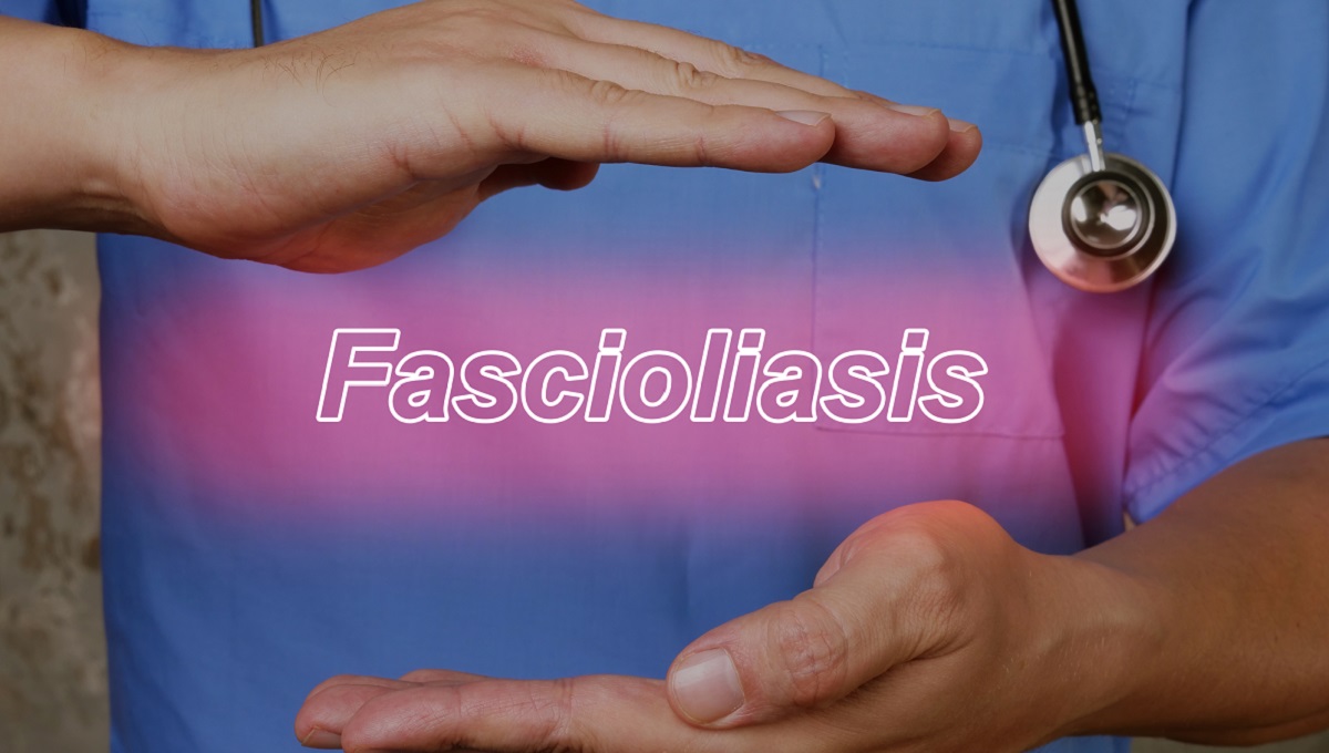 dreamstime_Fasciola fascioliasis parasite
