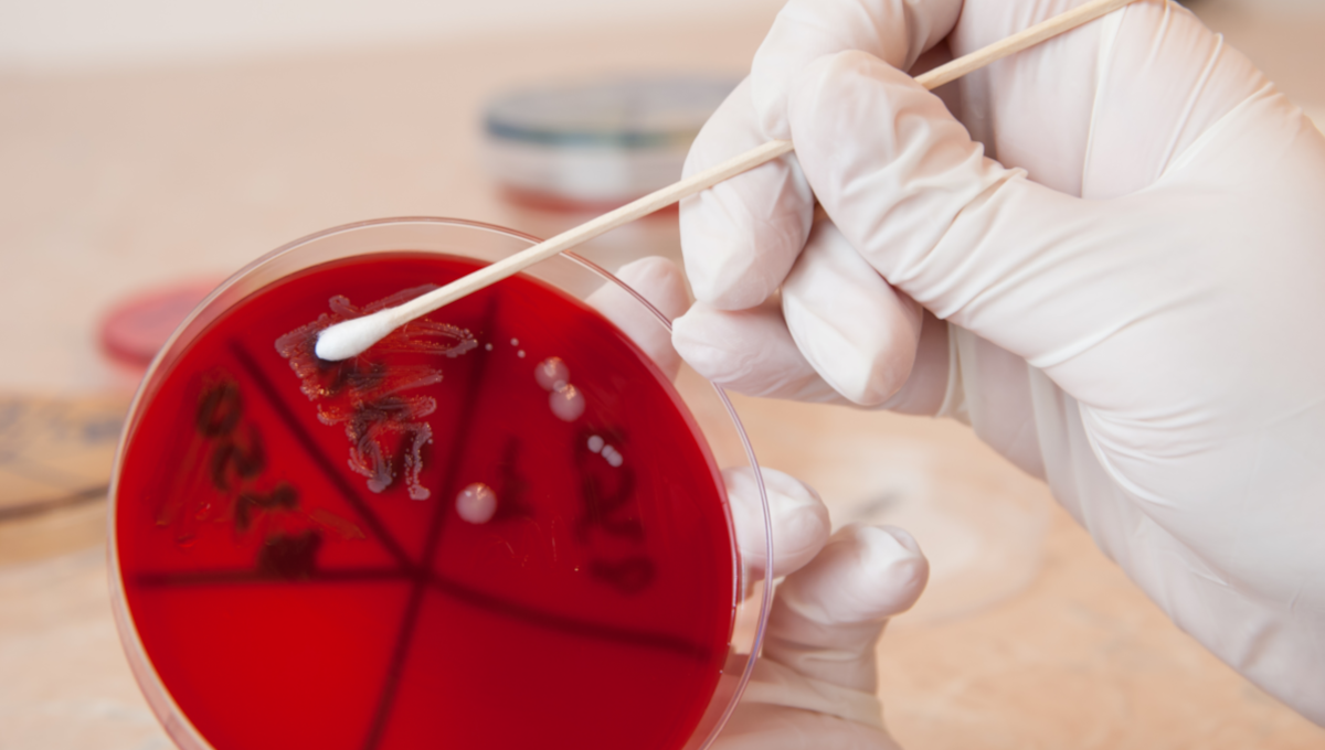Campylobacter test